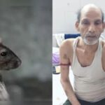 Nalanda hospital incident: नालंदा अस्पताल में चूहों ने काटी मरीज की उंगलियां जानिए कैसे हुआ यह हादसा