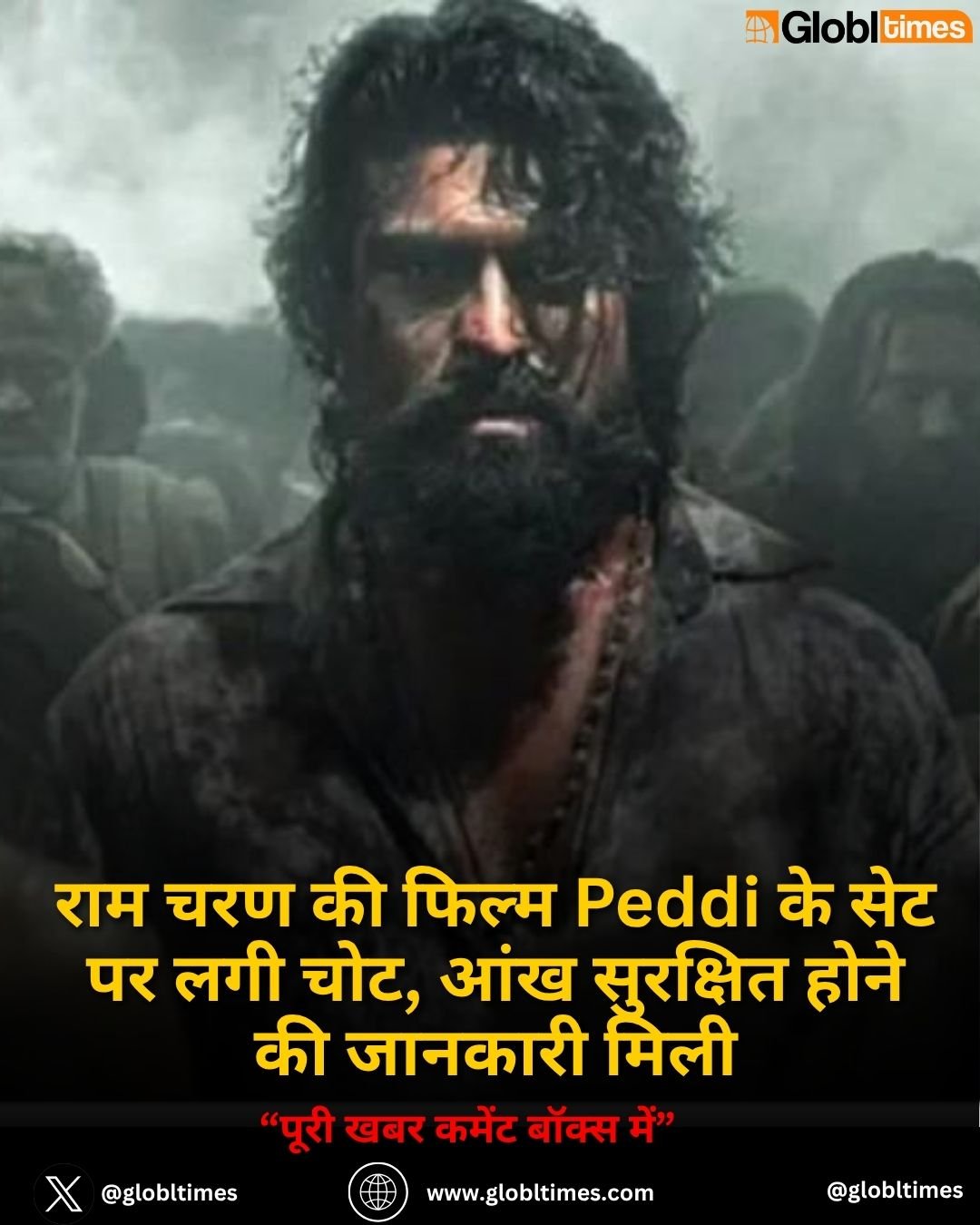 राम चरण की फिल्म Peddi के सेट पर लगी चोट, आंख सुरक्षित होने की जानकारी मिली