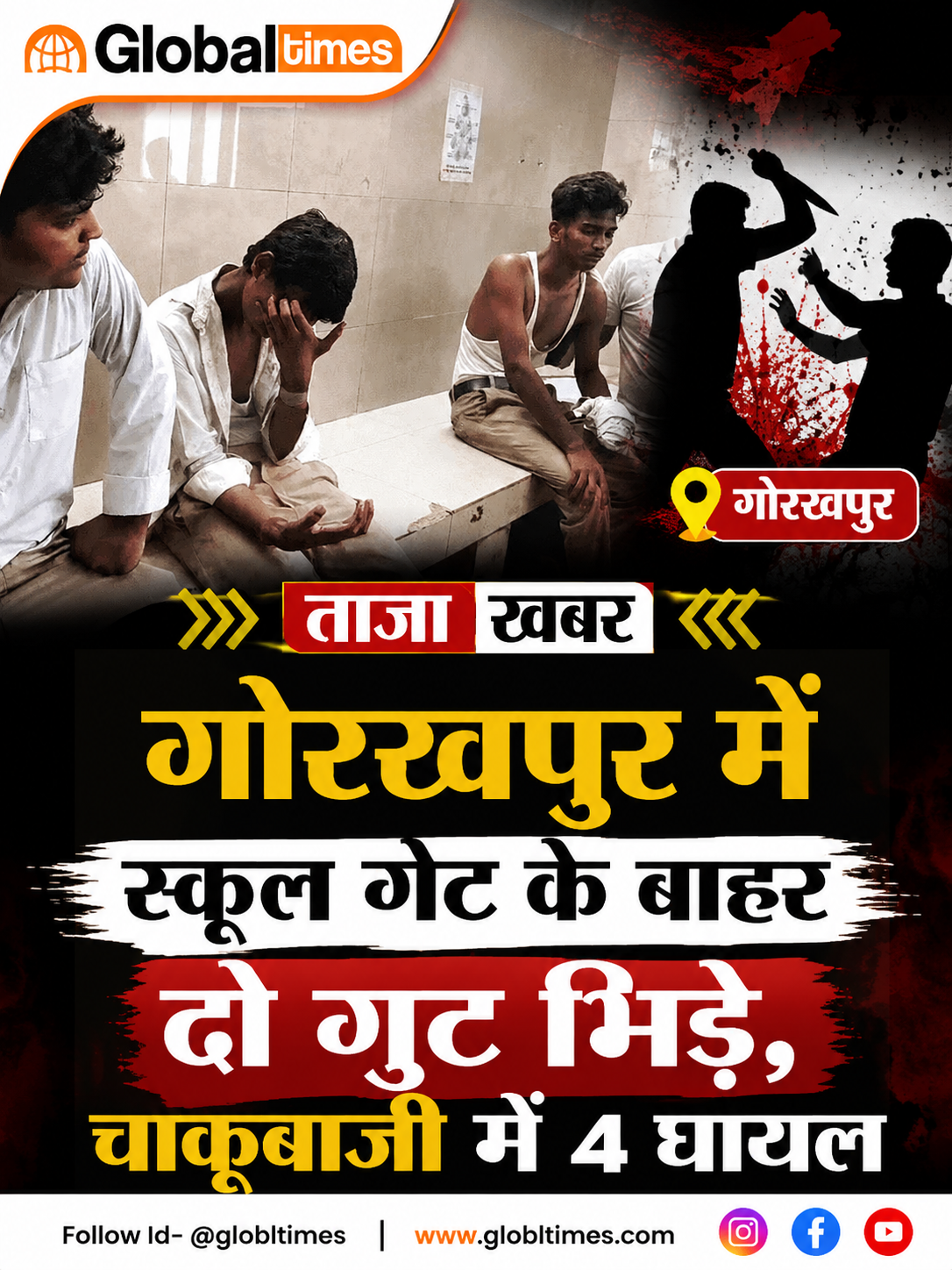 गोरखपुर में स्कूल गेट के बाहर छात्रों के दो गुट भिड़े, चाकूबाजी में 4 घायल